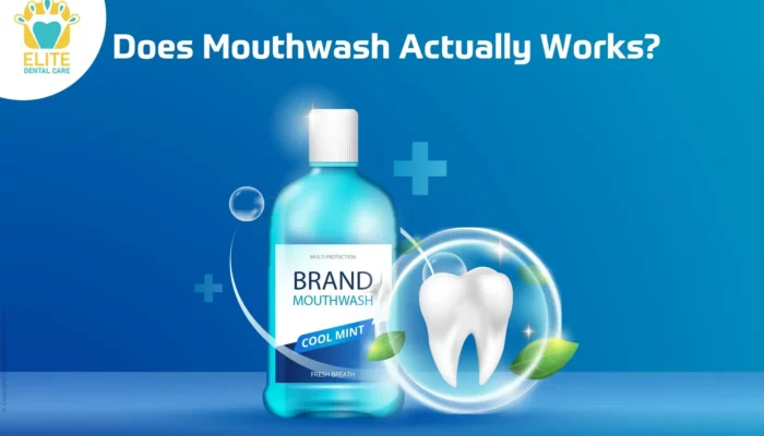 Resep Oxyfresh Mouthwash, Solusi Ampuh untuk Napas Segar dan Kesehatan Mulut Optimal, Coba Sekarang!