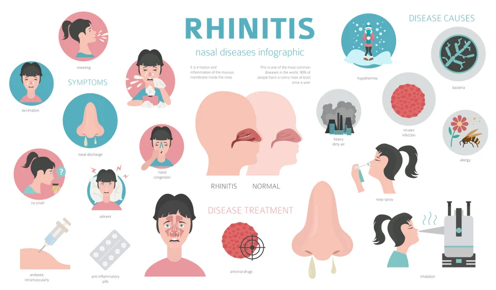 resep rhinitis alergi